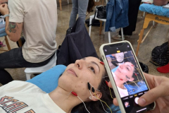 Bruxismo, Neuralgia de trigemino, parálisis facial